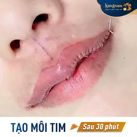 Môi Trái Tim Trong Nhân Tướng Học Môi Trái Tim Trong Nhân Tướng Học