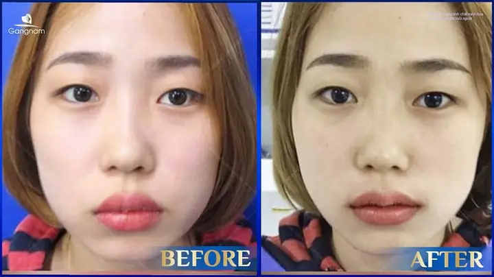 Môi Trên Dày Hơn Môi Dưới Tướng Số