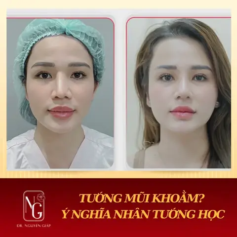 Mũi Khoằm Nhân Tướng Học