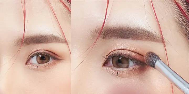 Mụn Mọc Ở Tai Điềm Báo