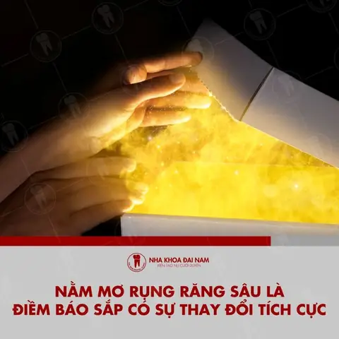 Nằm Mơ Bị Rụng Răng Là Điềm Báo Gì Nằm Mơ Bị Rụng Răng Là Điềm Báo Gì
