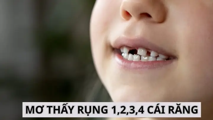 Nằm Mơ Rụng 1 Cái Răng Đánh De Con Gì
