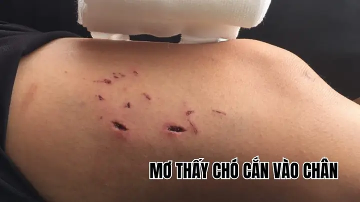 Nằm Mơ Thấy Chó Cắn Vào Chân Chảy Máu