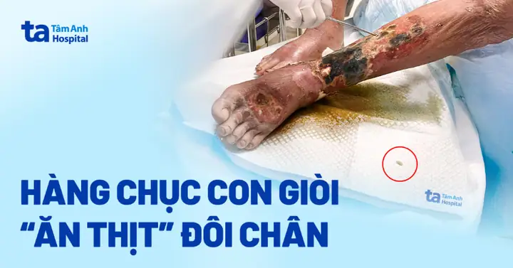 Nằm Mơ Thấy Con Dòi Đánh Số Mấy Nằm Mơ Thấy Con Dòi Đánh Số Mấy