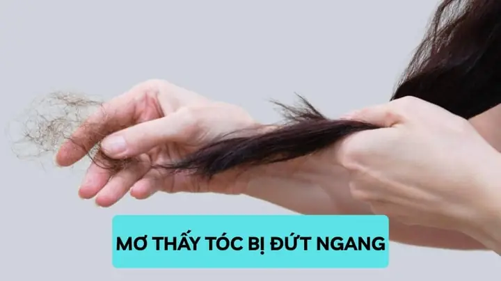 Nằm Mơ Thấy Gội Đầu Bị Rụng Tóc Nằm Mơ Thấy Gội Đầu Bị Rụng Tóc
