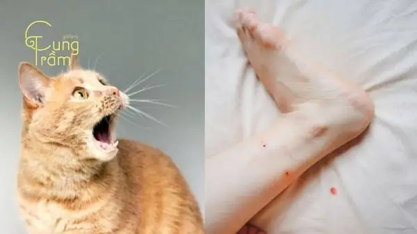 Nằm Mơ Thấy Mèo Cắn Vào Tay Chảy Máu Nằm Mơ Thấy Mèo Cắn Vào Tay Chảy Máu