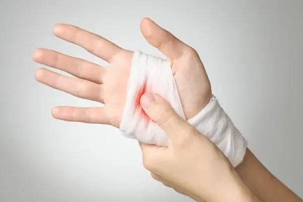 Nằm Mơ Thấy Người Khác Đứt Tay Chảy Máu Nằm Mơ Thấy Người Khác Đứt Tay Chảy Máu
