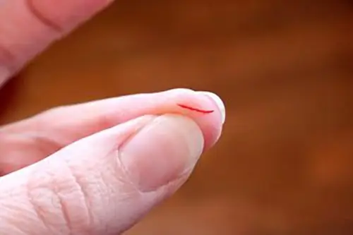 Nằm Mơ Thấy Người Khác Đứt Tay Chảy Máu Nằm Mơ Thấy Người Khác Đứt Tay Chảy Máu