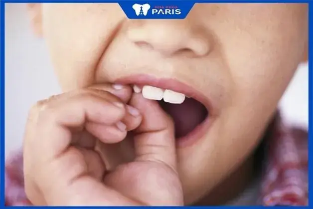 Nằm Mơ Thấy Nhổ Răng Cho Người Khác