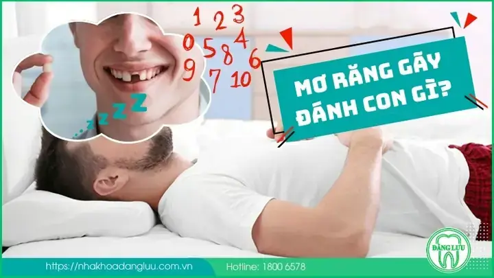 Nằm Mơ Thấy Răng Bị Mẻ Đánh Số May