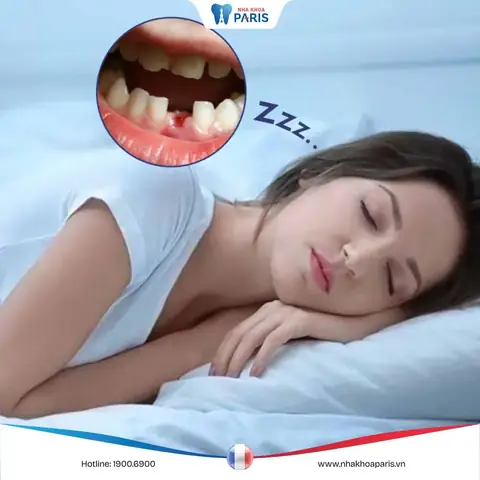 Nằm Mơ Thấy Rụng Hết 2 Hàm Răng Nằm Mơ Thấy Rụng Hết 2 Hàm Răng