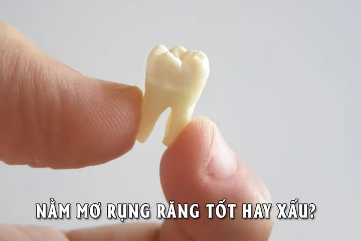 Nằm Mơ Thấy Rụng Răng Đánh Số May Nằm Mơ Thấy Rụng Răng Đánh Số May