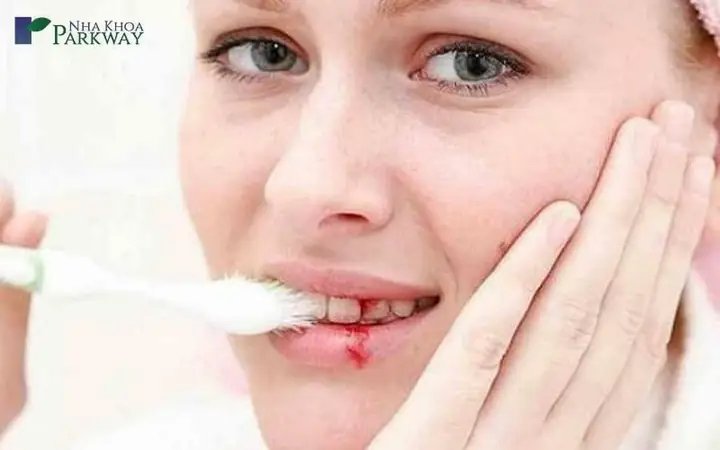 Nằm Mơ Thấy Rụng Răng Hàm Dưới Có Máu