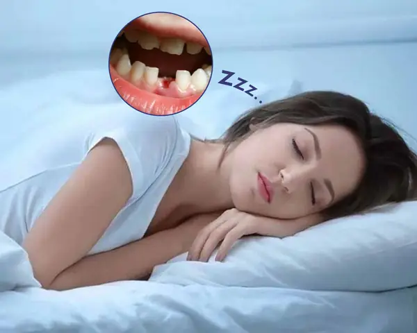 Nằm Mơ Thấy Rụng Răng Hàm Dưới Không Chảy Máu