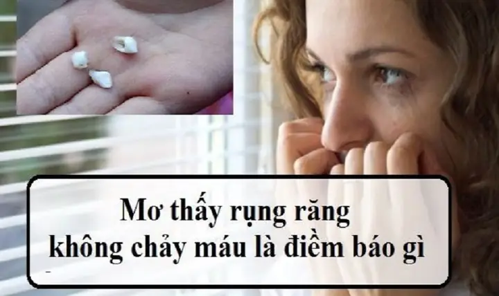 Nằm Mơ Thấy Rụng Răng Hàm Trên Chảy Máu