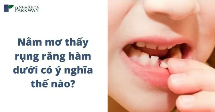 Nằm Mơ Thấy Rụng Răng Hàm Trên Chảy Máu