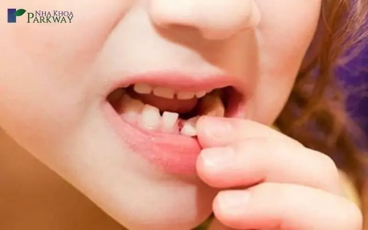 Nằm Mơ Thấy Rụng Răng Không Chảy Máu