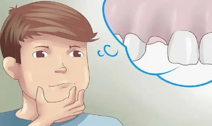 Nằm Mơ Thấy Rụng Răng Là Điềm Gì