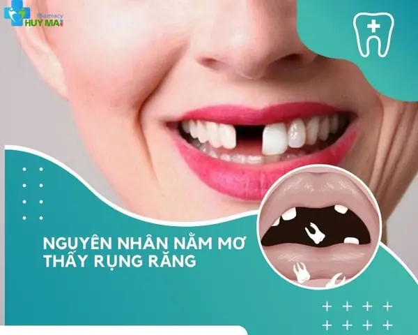 Nằm Mơ Thấy Rụng Răng Tốt Hay Xấu
