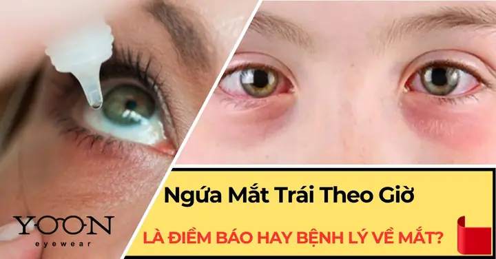 Ngứa Mắt Trái Nấm La Điềm Gì Ngứa Mắt Trái Nấm La Điềm Gì