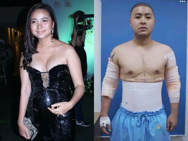 Người Phát Tướng