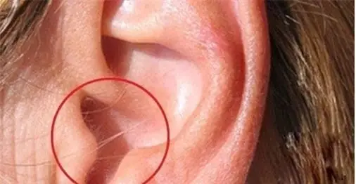 Nhân Tướng Học, Lông Mọc Trong Tai