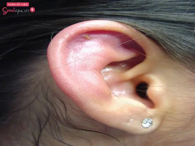 Nhân Tướng Học, Lông Mọc Trong Tai