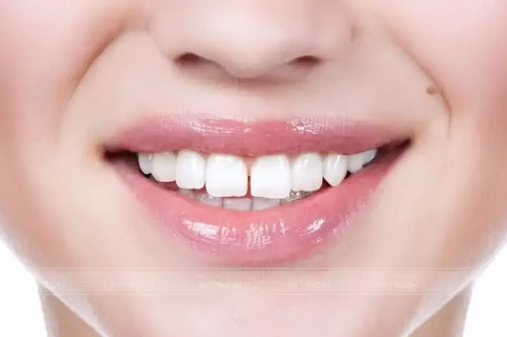 Nhổ Răng Có Ảnh Hưởng Đến Tướng Số