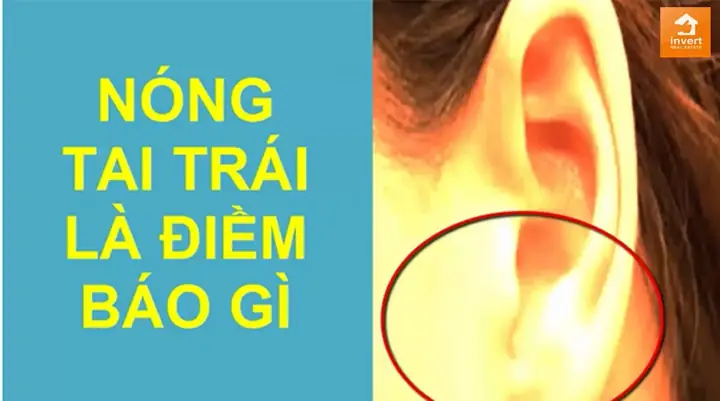 Nóng Tai Trái Ở Nữ Điềm Báo Gì