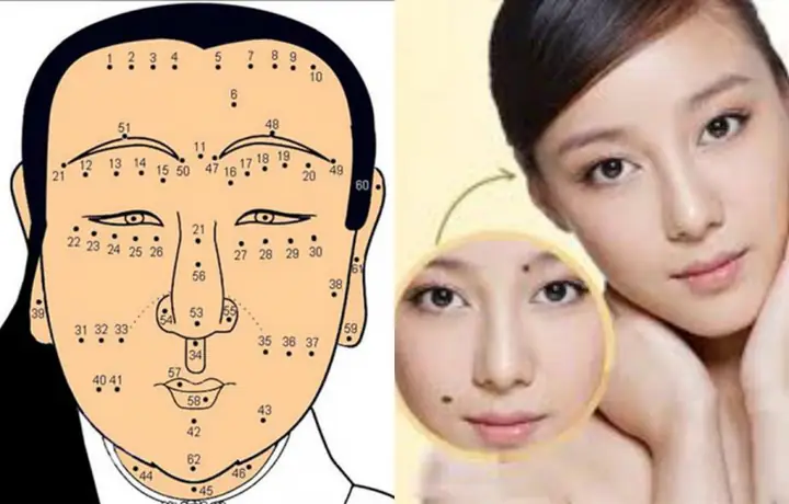 Nốt Ruồi Phá Tướng