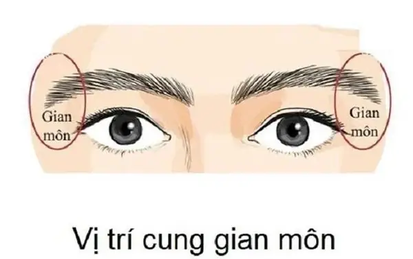 Nốt Ruồi Phá Tướng