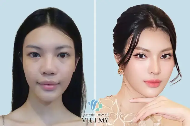Phẫu Thuật Thẩm Mỹ Có Thay Đổi Tướng Số