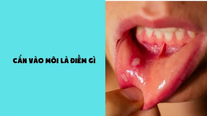 Quả Rơi Vào Người Là Điềm Gì