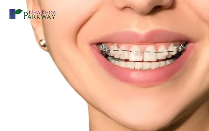 Răng Cửa Họ Trong Tướng Số Răng Cửa Họ Trong Tướng Số