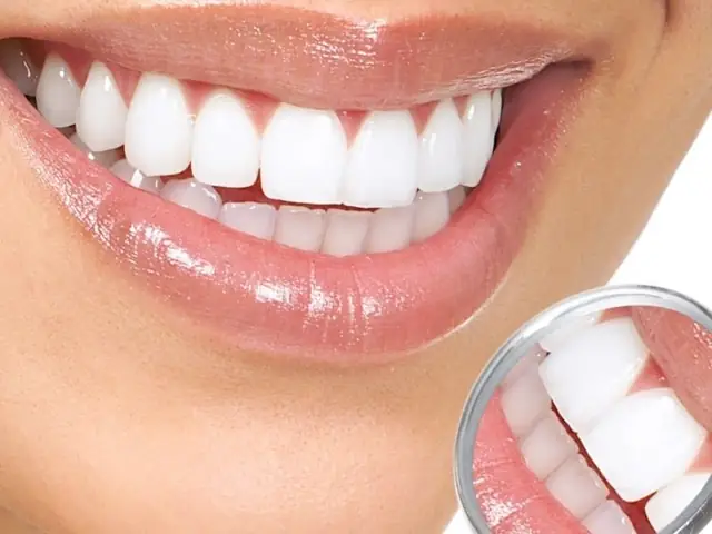 Răng Đều Hạt Bắp Tướng Số