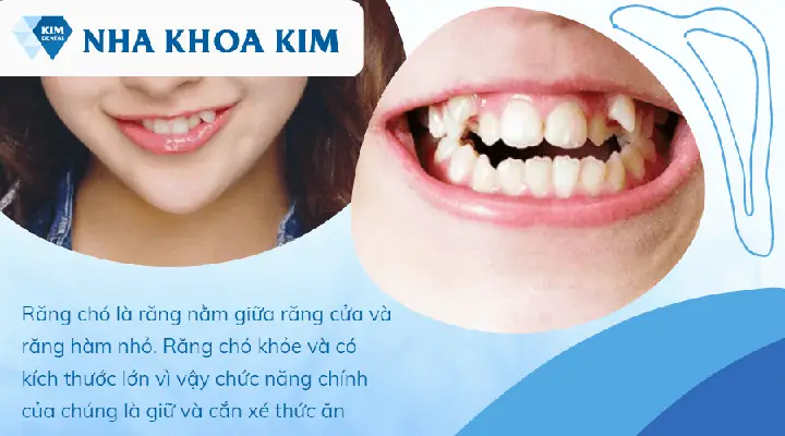 Răng Hàm Dưới Không Đều Nhân Tướng Học