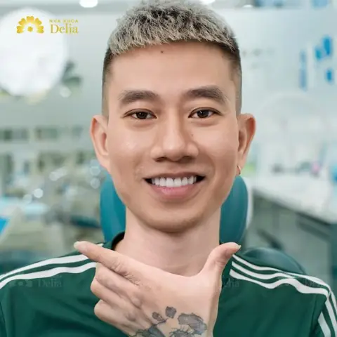 Răng Nhọn Tướng Số Răng Nhọn Tướng Số