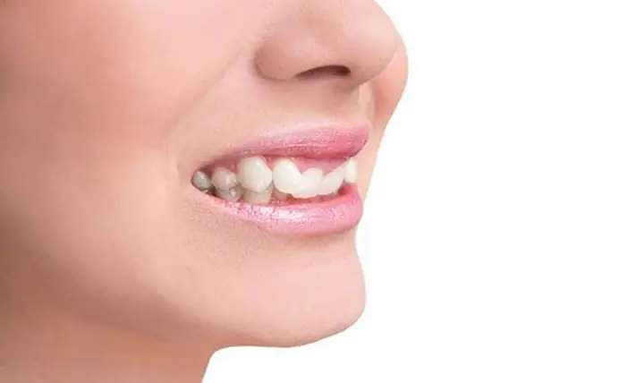 Răng Quặp Vào Trong Tướng Số