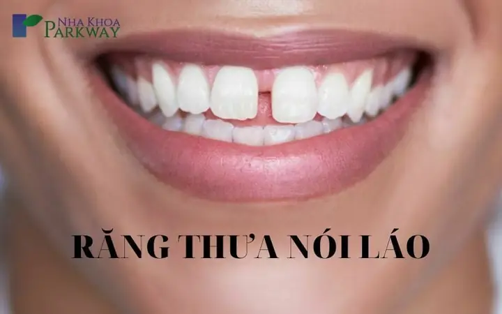 Răng Thưa Hàm Dưới Tướng Số