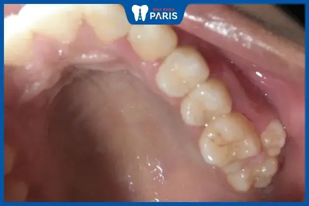 Số 9 Là Điềm Báo Gì Số 9 Là Điềm Báo Gì
