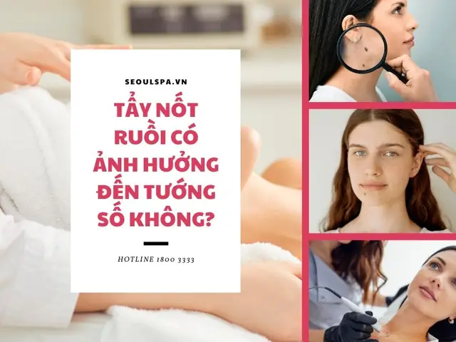 Tẩy Nốt Ruồi Có Ảnh Hưởng Đến Tướng Số Không Tẩy Nốt Ruồi Có Ảnh Hưởng Đến Tướng Số Không