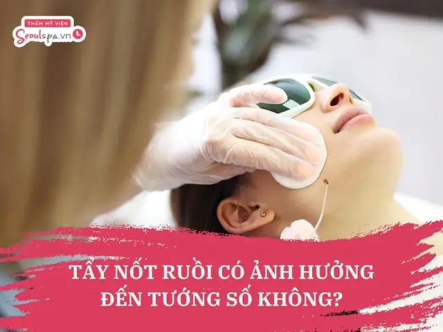 Tẩy Nốt Ruồi Có Ảnh Hưởng Đến Tướng Số Không Tẩy Nốt Ruồi Có Ảnh Hưởng Đến Tướng Số Không