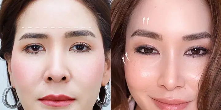 Thay Đổi Tướng Số Trên Khuôn Mặt Thay Đổi Tướng Số Trên Khuôn Mặt