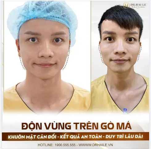 Thay Đổi Tướng Số Trên Khuôn Mặt Thay Đổi Tướng Số Trên Khuôn Mặt
