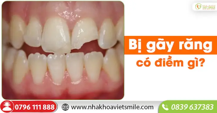 Tự Nhiên Bị Gãy Răng Có Điềm Gì Tự Nhiên Bị Gãy Răng Có Điềm Gì