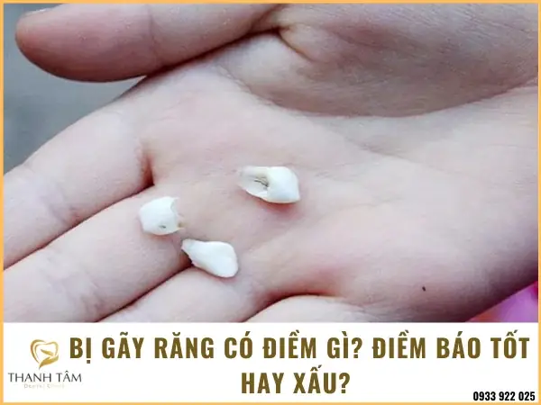 Tự Nhiên Bị Gãy Răng Có Điềm Gì Tự Nhiên Bị Gãy Răng Có Điềm Gì