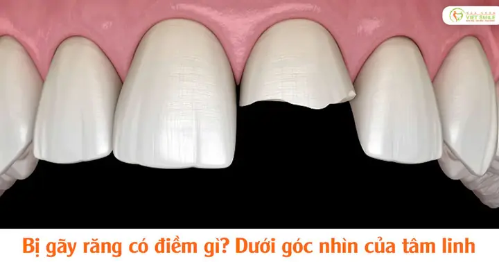 Tự Nhiên Bị Gãy Răng Có Điềm Gì