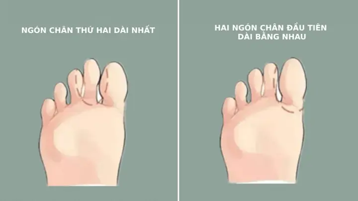 Tướng Bàn Chân Giàu Có