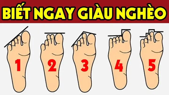 Tướng Bàn Chân Khổ