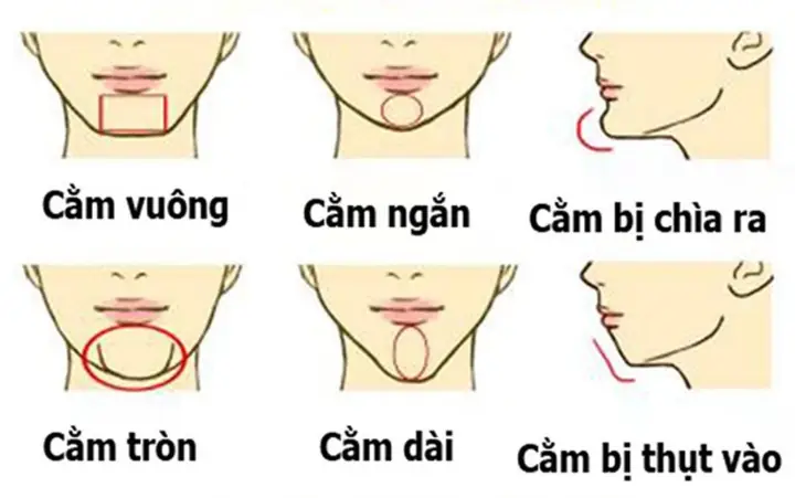 Tướng Cằm Thụt Vào